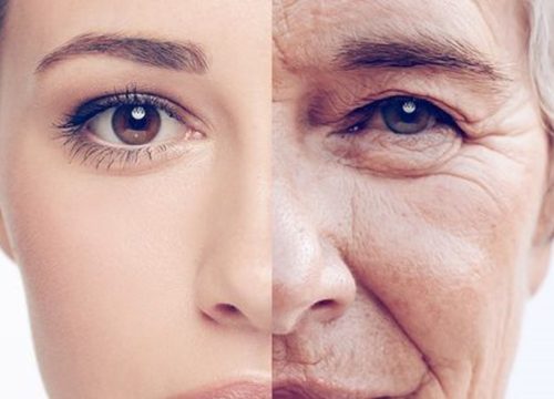 Aging Skin