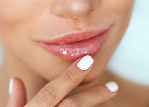 Woman with fuller lips after JUVÉDERM® treatment