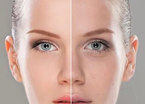 dull skin