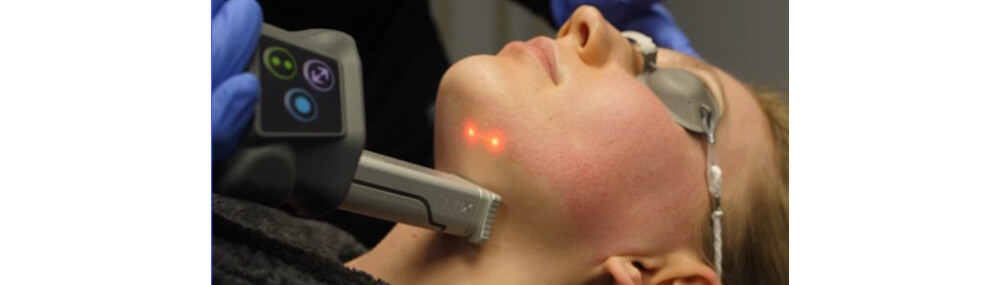 CO2 & 1570nm Fractional Laser